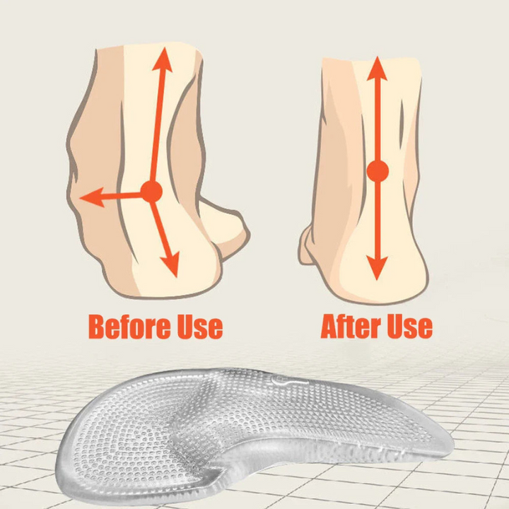 Drune | Orthopädische Einlegesohlen Aus Silikon Gel